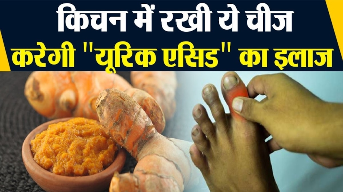 Uric Acid Treatment at Home in Hindi – Simple Guide