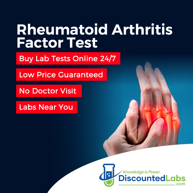 Blood Test for Arthritis in Hands: Essential Guide