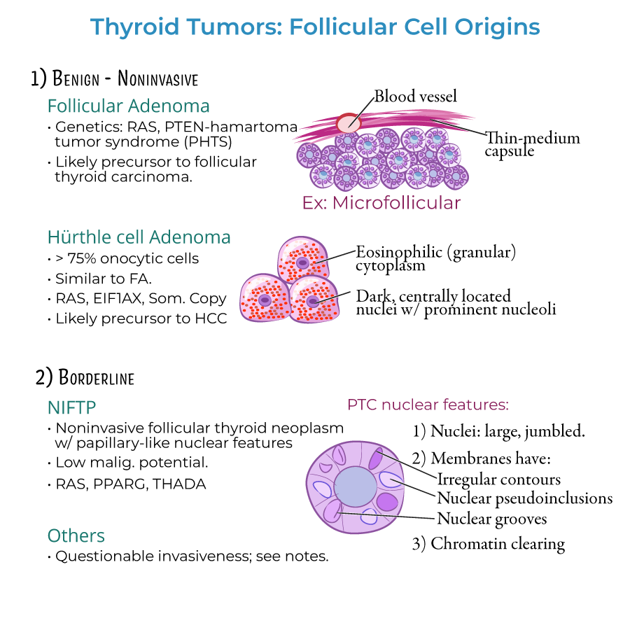 Follicular Thyroid Cancer: Symptoms & Treatment