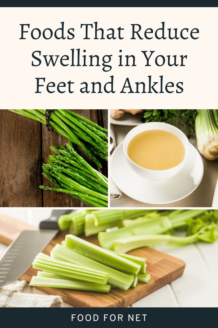 Top Foods That Reduce Swelling in Feet and Ankles