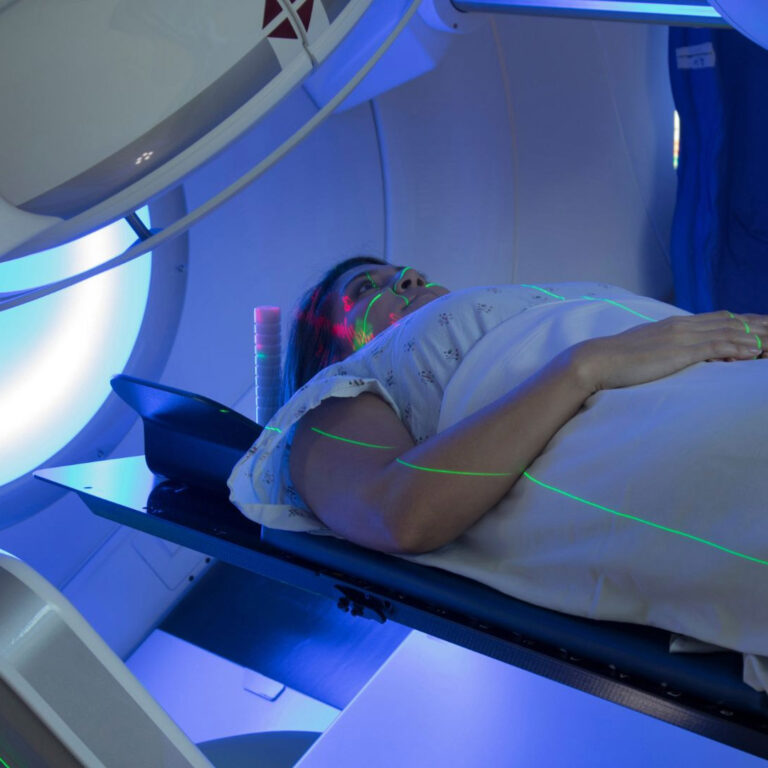 How Long Does It Take to Recover from Proton Therapy? Real Facts