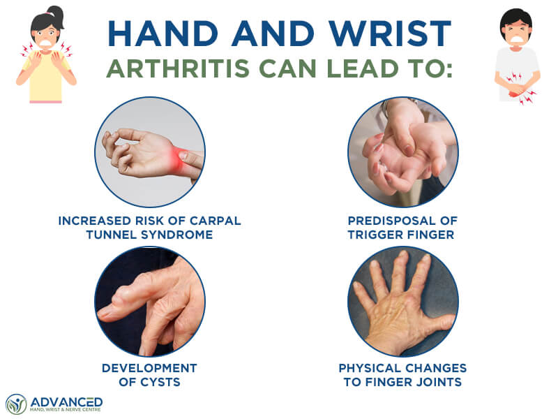 How to Test for Arthritis in Hands: Simple Steps