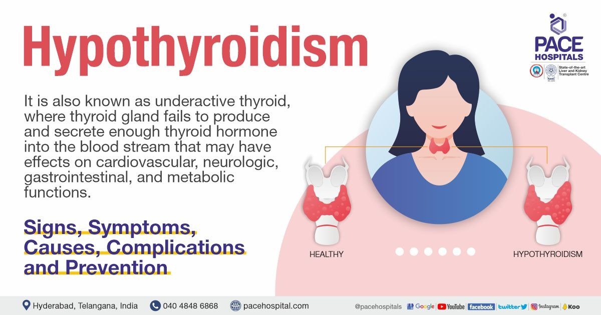 Hypothyroidism: Signs, Causes, Diagnosis & Treatment