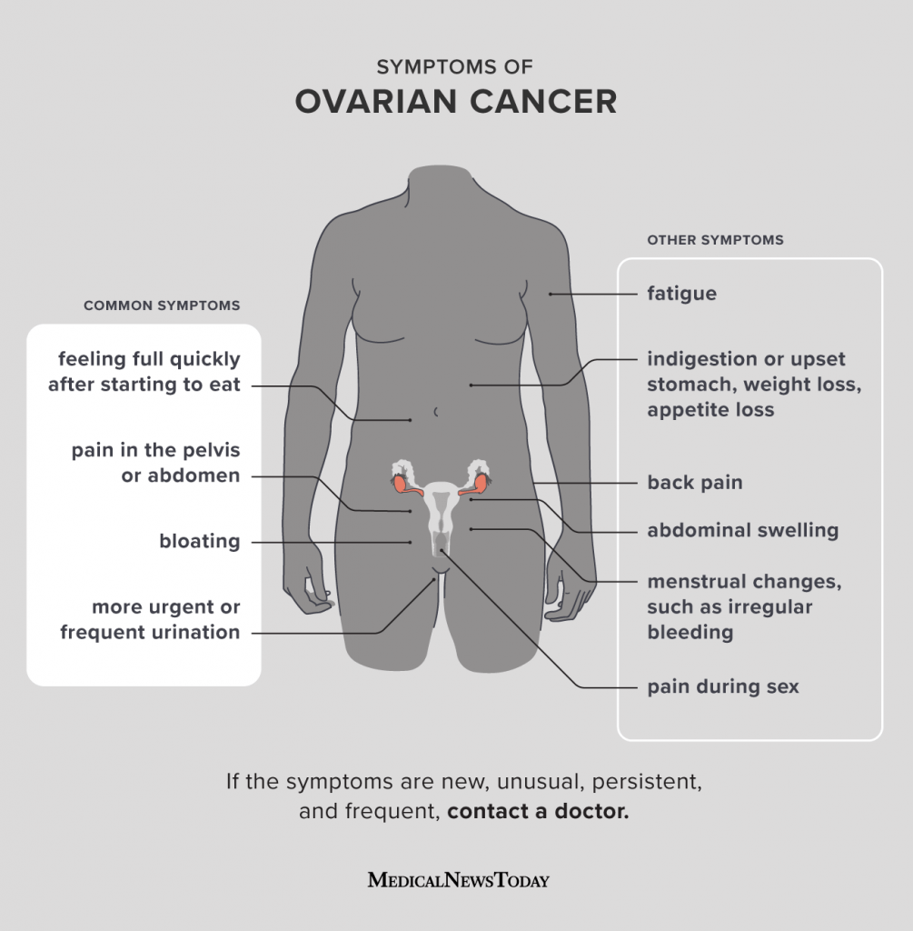 My First Symptoms of Ovarian Cancer: What to Watch For