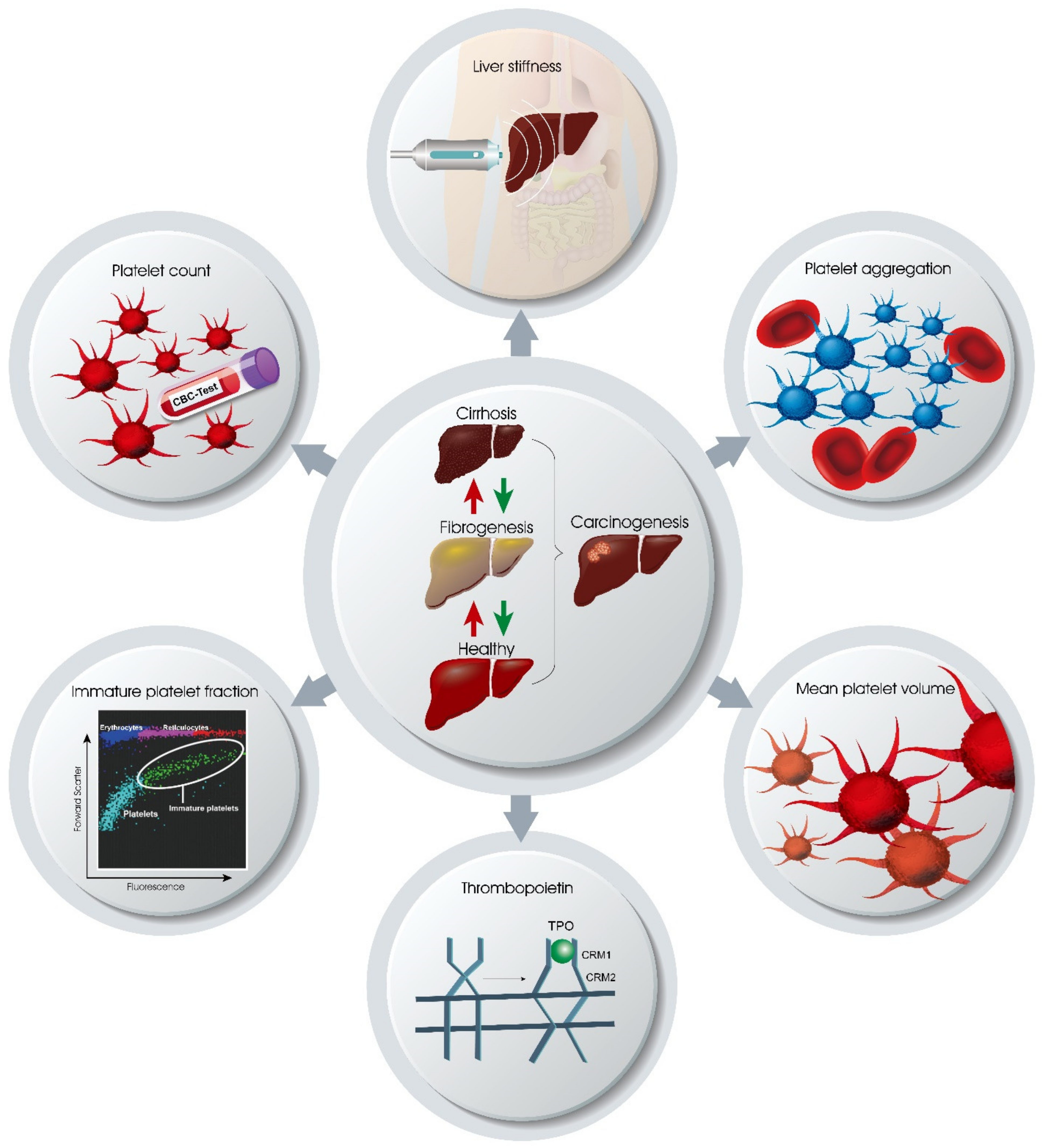 What Is a Normal Platelet Count in Cirrhosis?