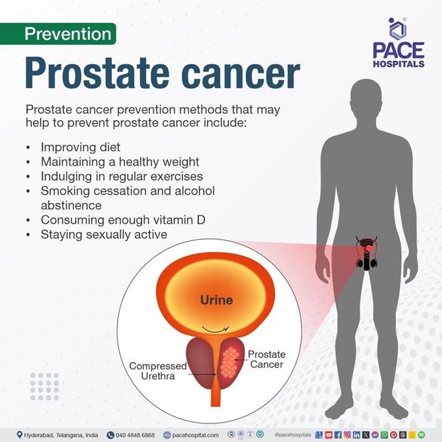 Prostate Cancer Prevention Medication: Benefits & Risks