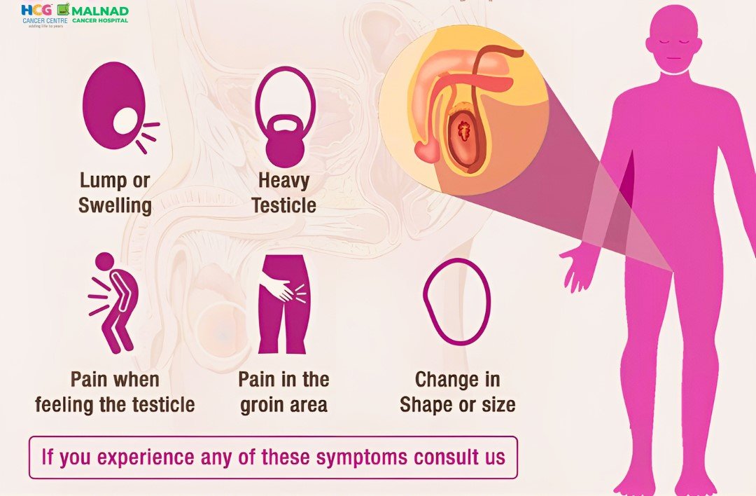 Understanding Testicular Cancer Back Pain Feeling
