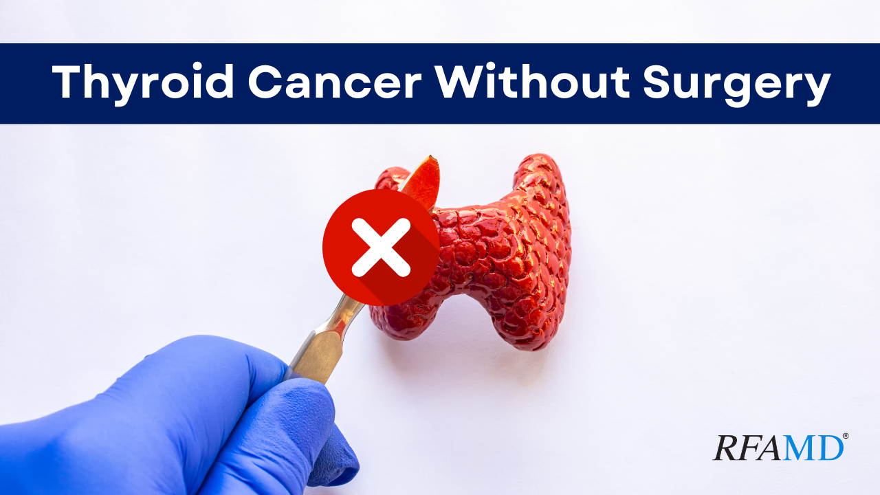Thyroid Cancer Treatment Without Surgery: What Works