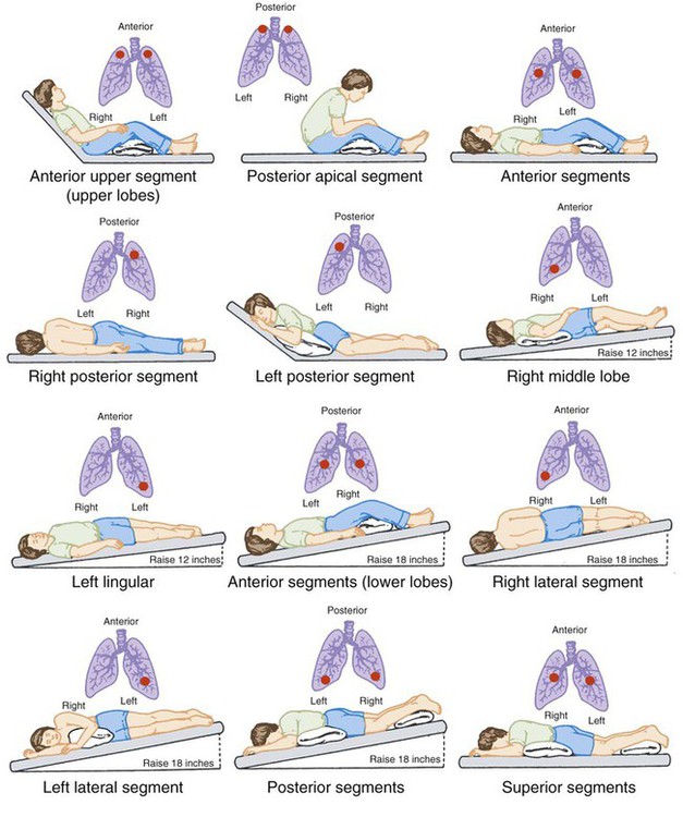 Airway Clearance Protocol: Simple Steps for Clear Lungs