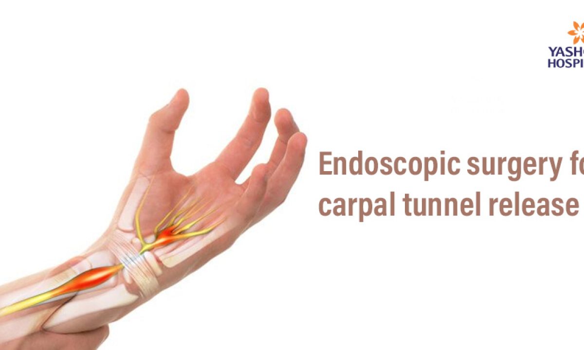 Carpal Tunnel Supplements Reddit: Real User Picks