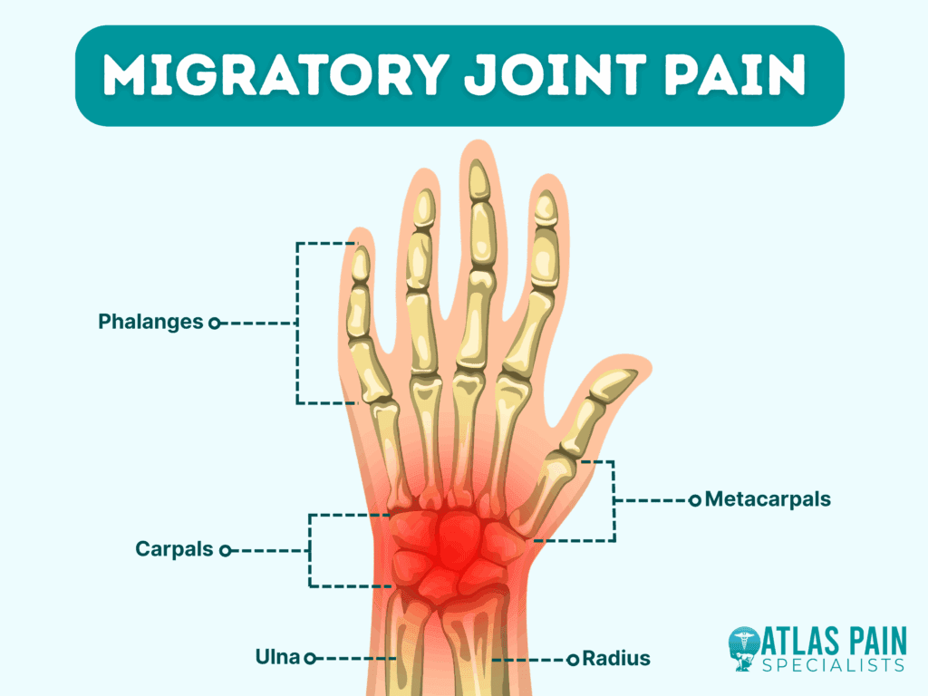Causes of Migratory Arthritis: What Triggers Joint Pain
