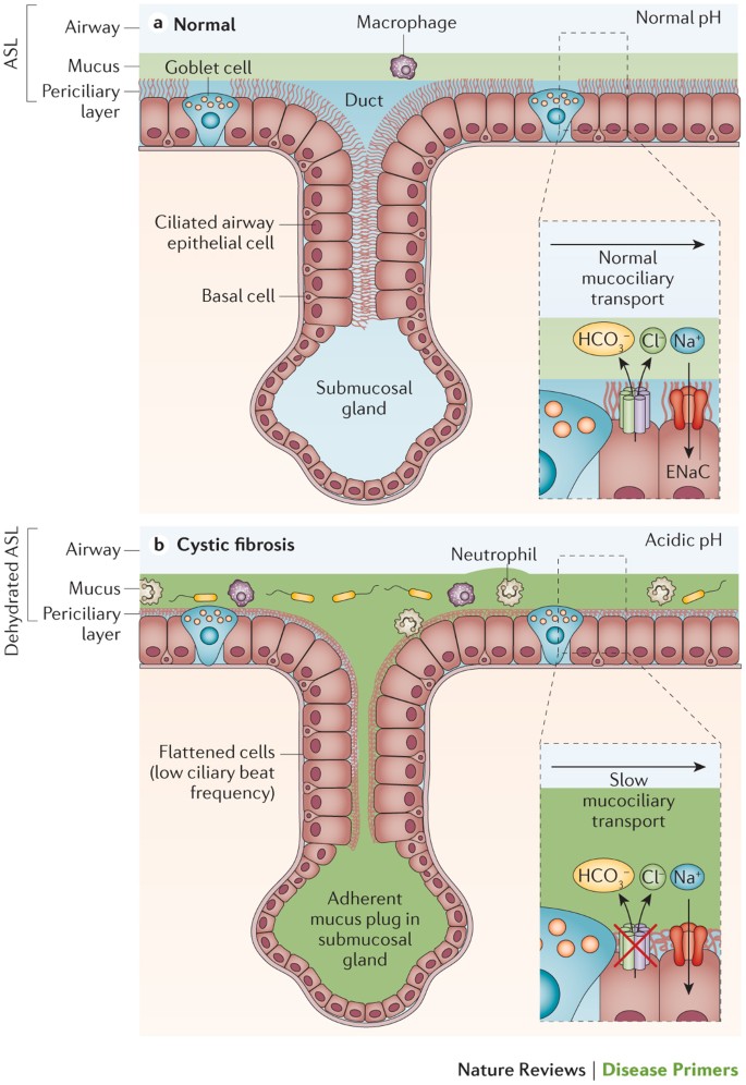 Cystic Fibrosis Physiology: Essential Facts & Insights