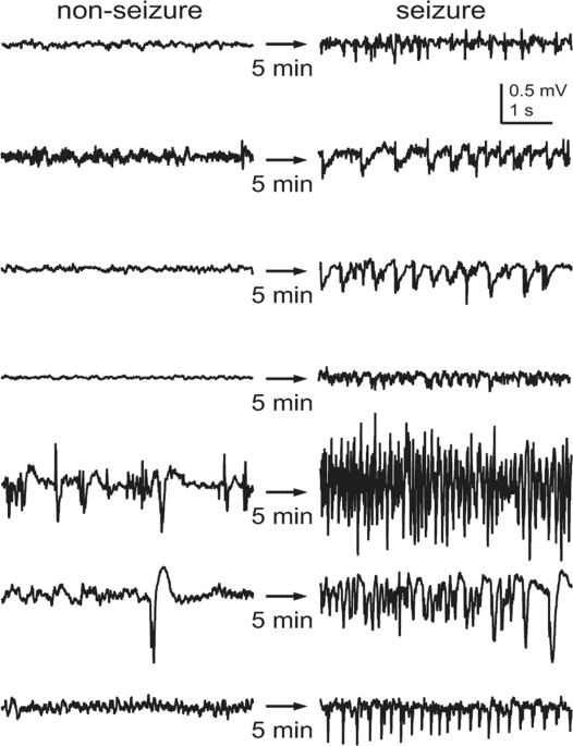 How far back can an EEG detect a seizure episode?