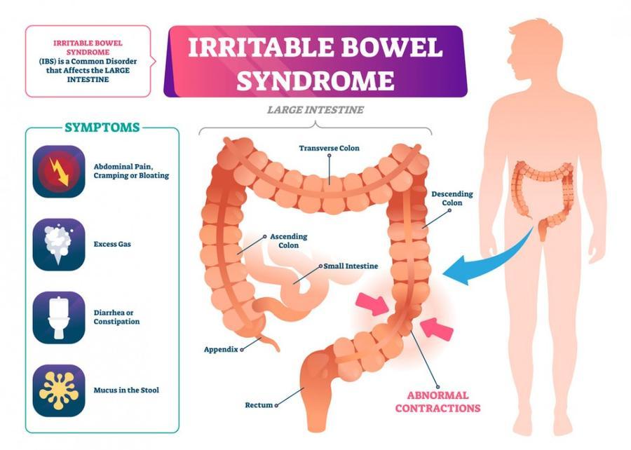 Irritable Bowel Syndrome Treatments: Practical Tips