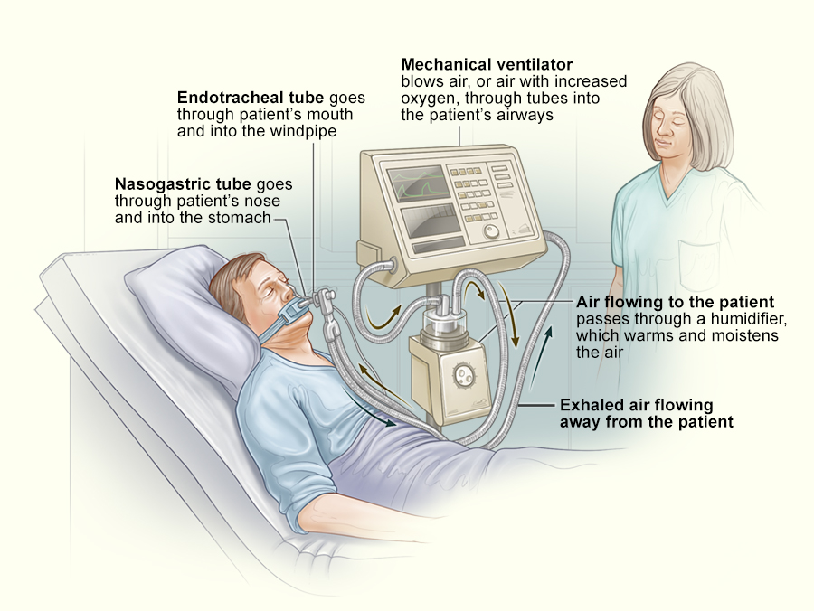 Machine to Help Breathing in Hospital: Key Facts & Tips