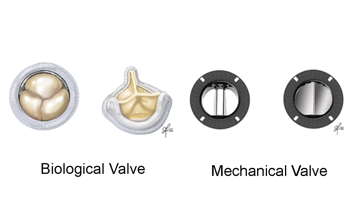 Mechanical Valve Types: Quick Guide to What Matters Most