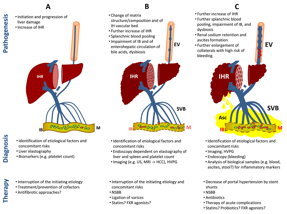 Natural Treatment Options for Portal Hypertension