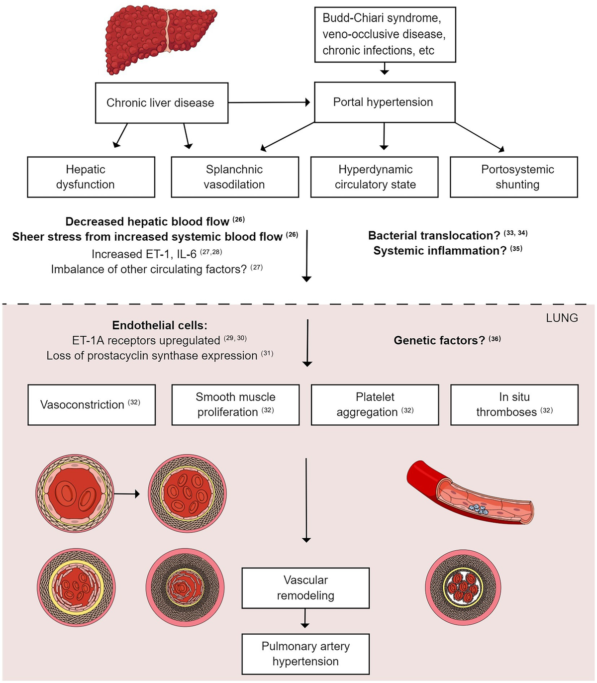 Portopulmonary Hypertension Mechanism: What Happens?