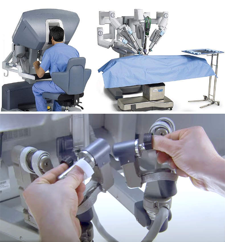 Pros and Cons of Robotic Prostate Surgery Explained