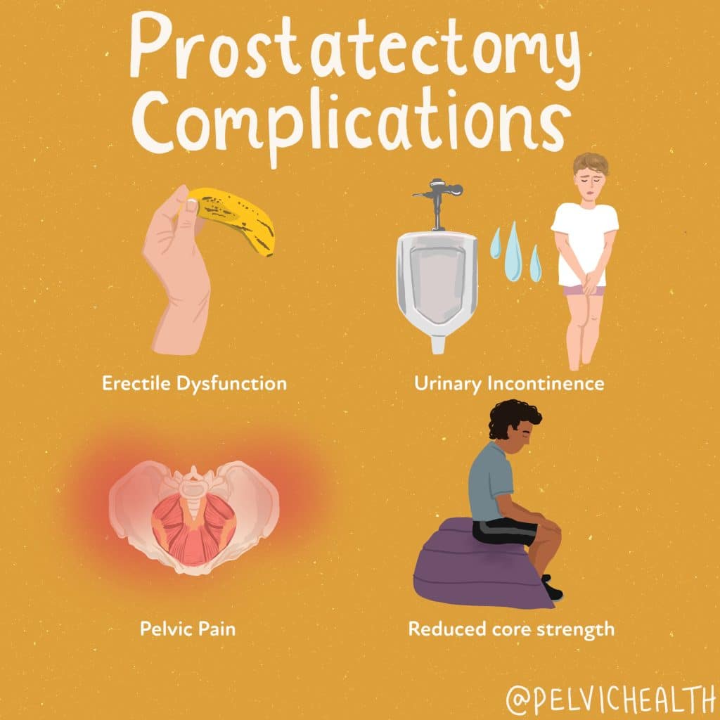 Prostatectomy Complications: What You Need to Know