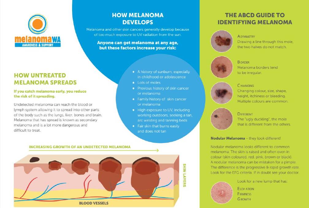 Key Signs of Melanoma in Blood Work You Should Know
