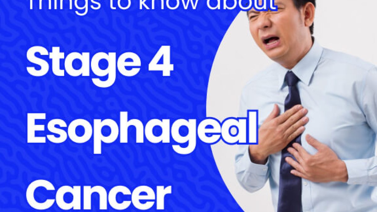 Stage 4 Esophageal Cancer Life Expectancy & Treatment