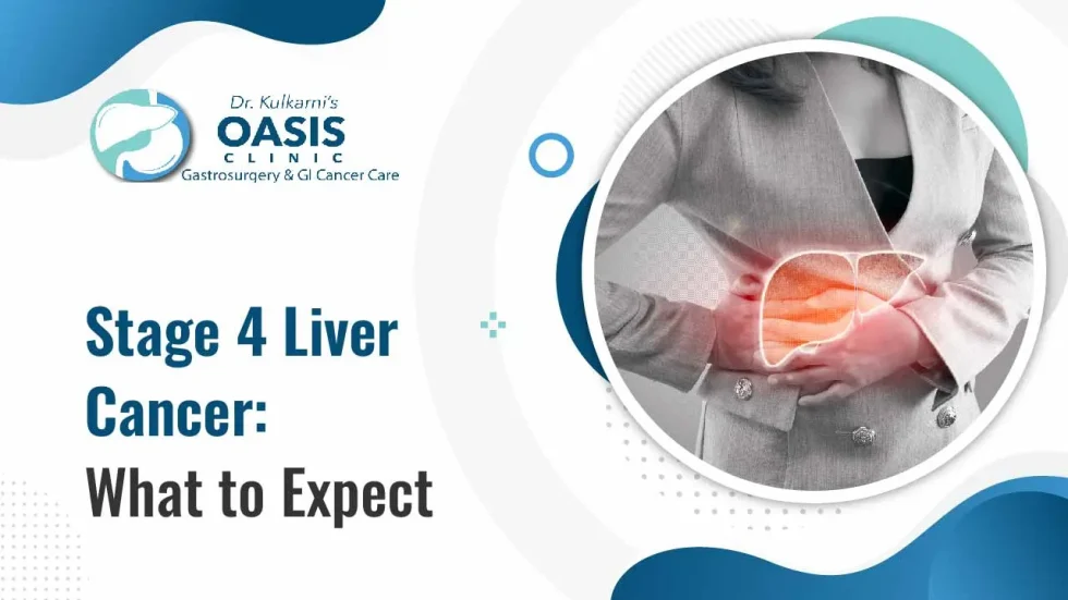 Stage 4 Liver Cancer: How Long Can You Live Really?