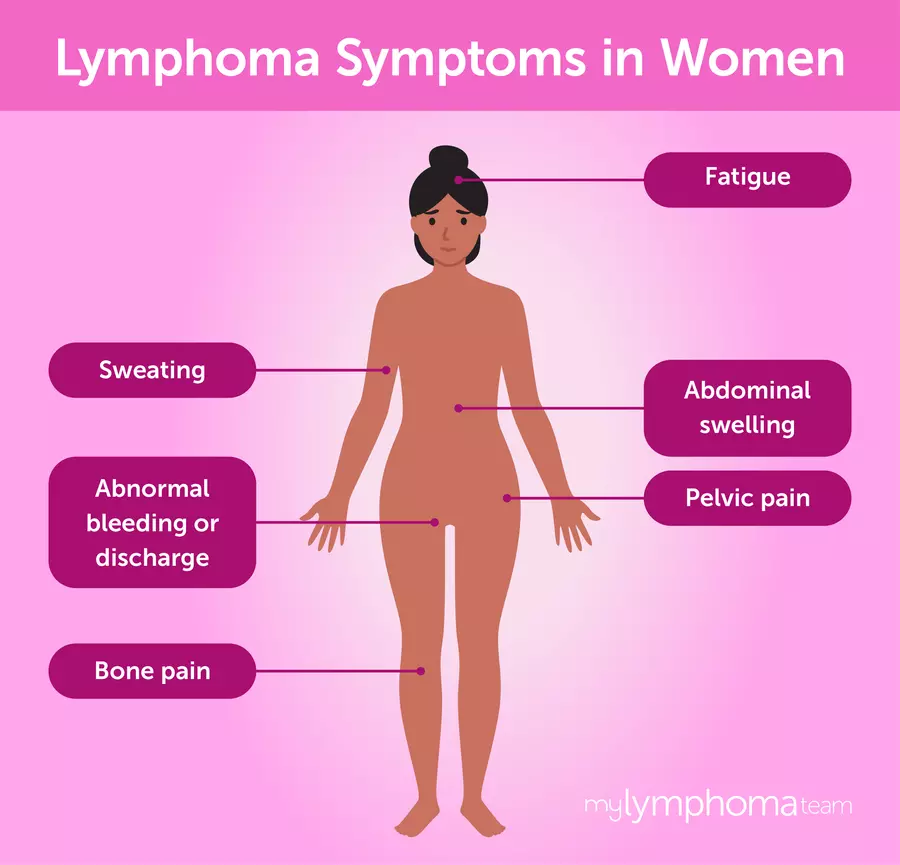 Symptoms of Lymphoma in Females: What You Need to Know