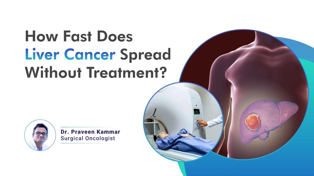 Terminal liver cancer: how long to live, what to know