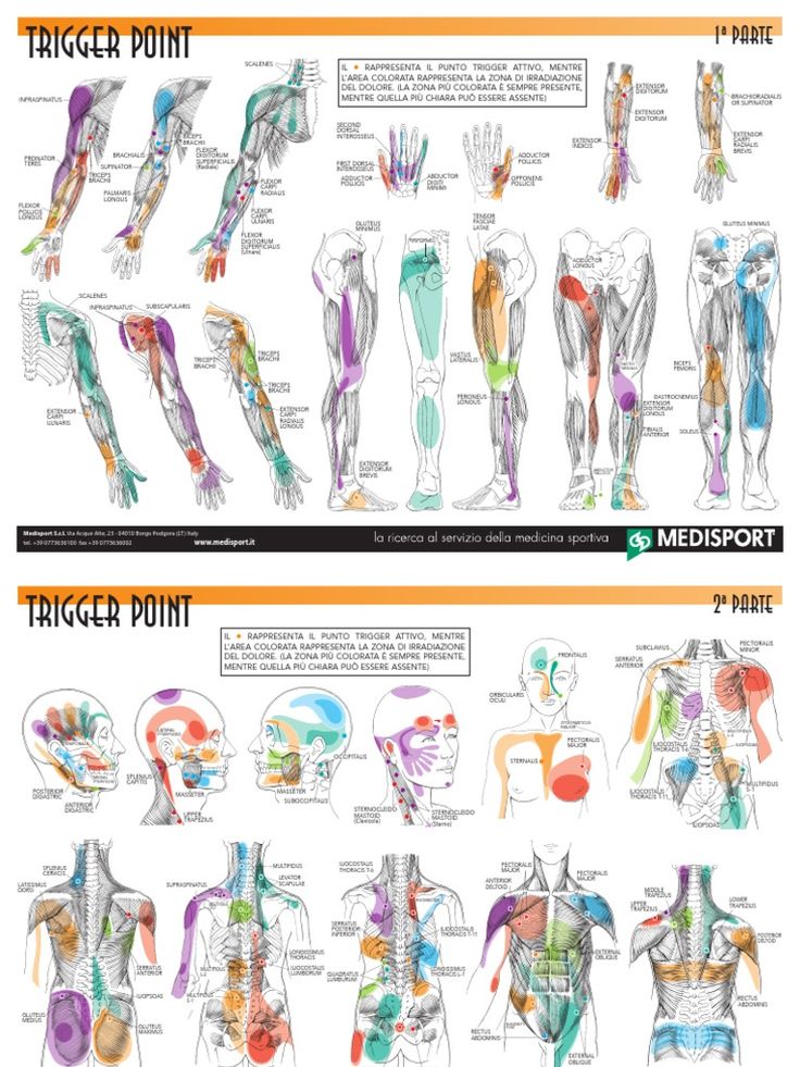 Trigger Points Chart PDF – Free Download & Quick Guide