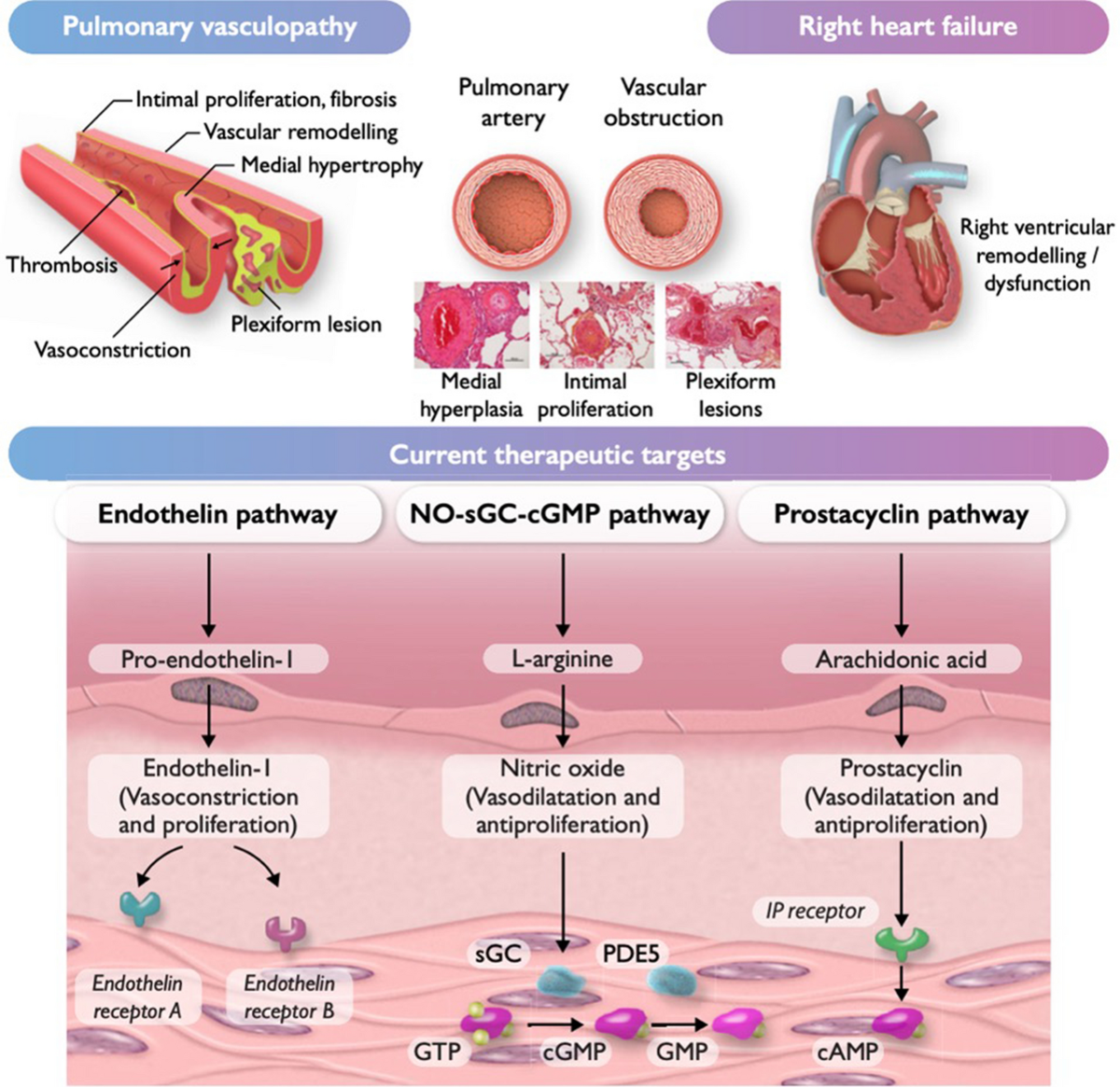 What Is the Best Medication for Pulmonary Hypertension?