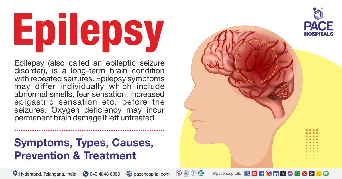 Is Epilepsy Curable? What You Really Need to Know
