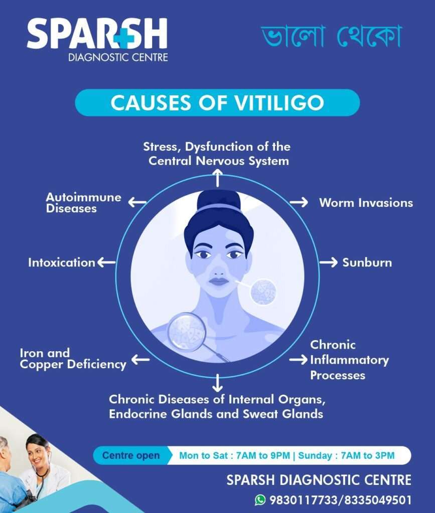 Is Vitiligo Genetic or Environmental? Quick Answers