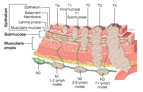 TNM Staging Stomach Cancer: Complete Pathology Outlines