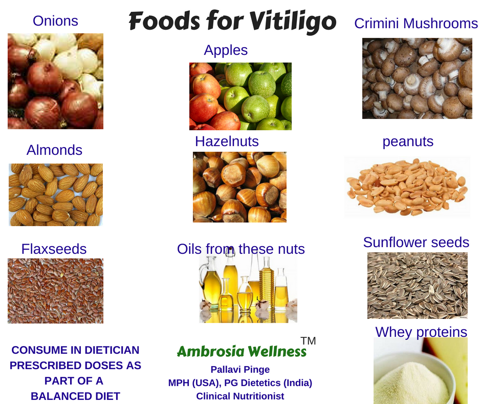 Vitiligo Avoid Food: Simple Steps to Protect Your Skin