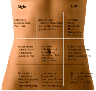 Where Is Constipation Pain Felt? A Friendly Guide