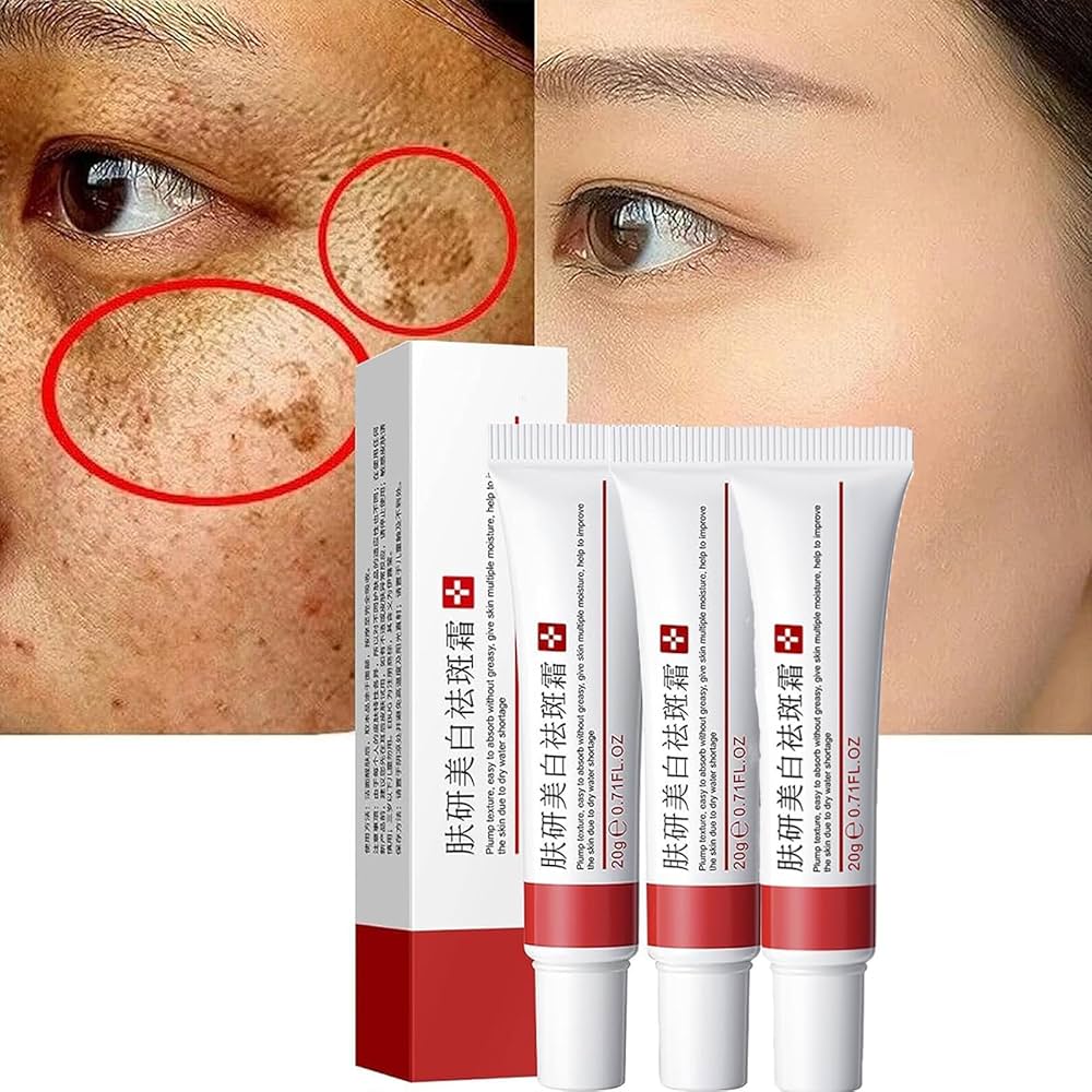 Crema Para Manchas En La Cara Farmacia