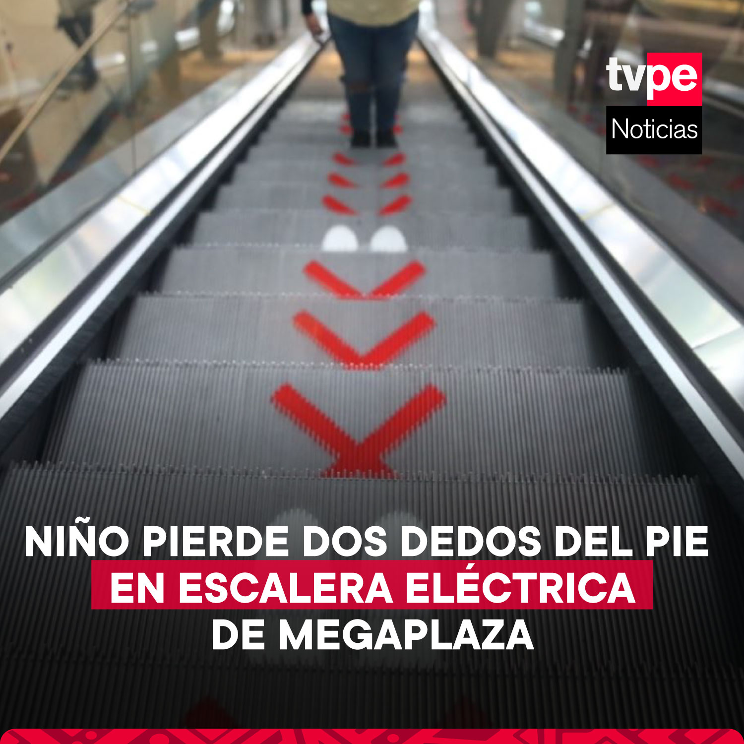 Megaplaza Niño Pierde Dos Dedos