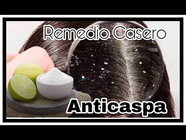 Remedios Caseros Para La Caspa Y Comezón