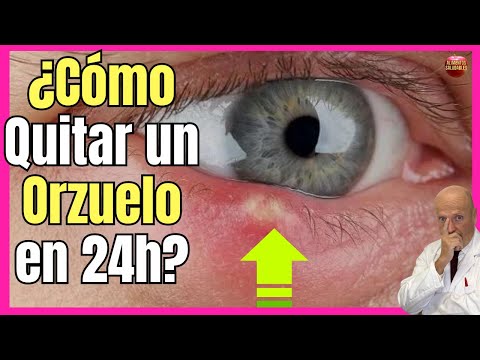 Como Quitar Un Orzuelo Con Una Cuchara