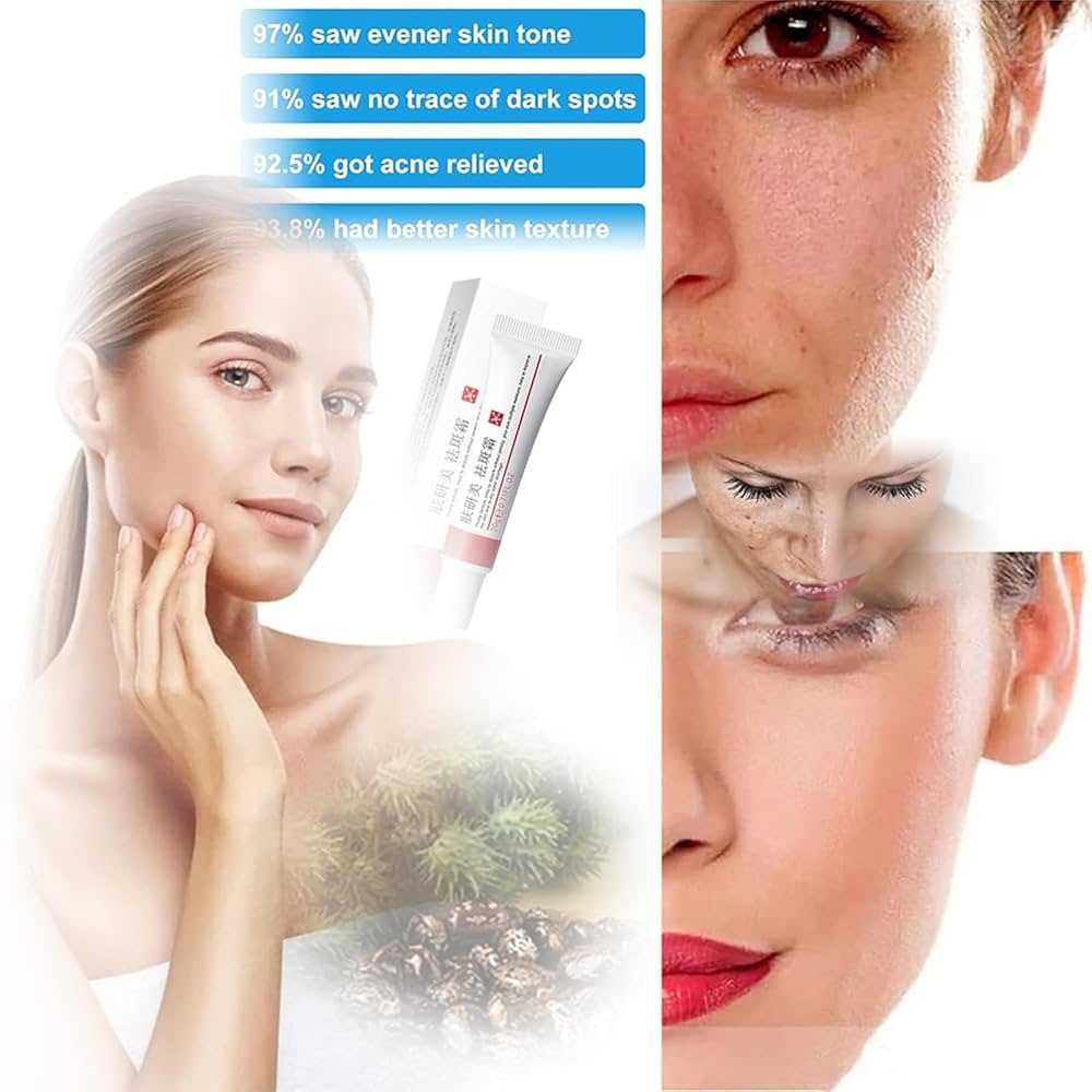 Crema Para Manchas En La Cara In English